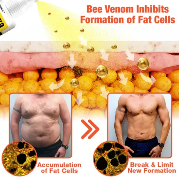 GFOUK™ HexaBurn Bee Venom Gynecomastia Spray