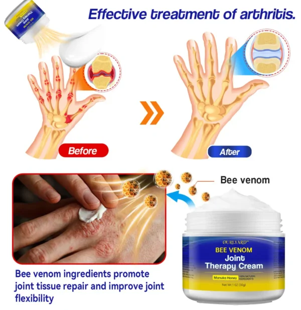 Ourlyard™ Bee Venom Joint Therapy Cream