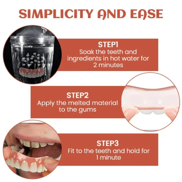 Seurico™ Denture Silicone Reline Kit