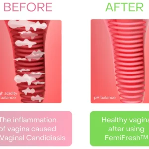 AEXZR™ Vaginal Cleaning Patch