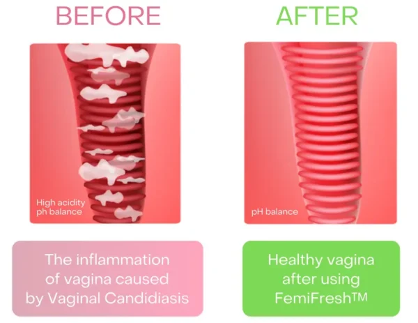 AEXZR™ Vaginal Cleaning Patch