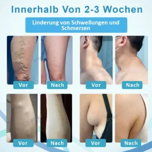 ATTDX™ LumpenKlar Lymphunterstützungs Roll-On