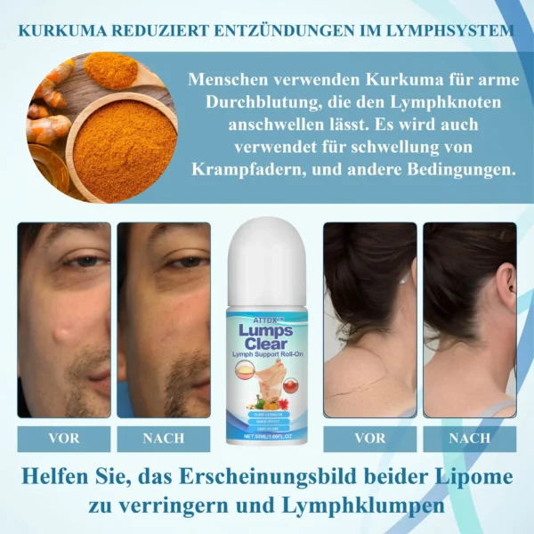 ATTDX™ LumpenKlar Lymphunterstützungs Roll-On