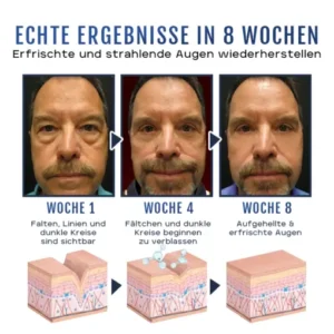 Biancat™ AlphaFirm Augen Lifting Peptid-Gel