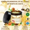 Brezey™ Bee Venom Mole and Wart Treatment Cream