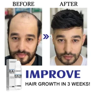 Dobshow™ Hair Rejuvenation Treatment