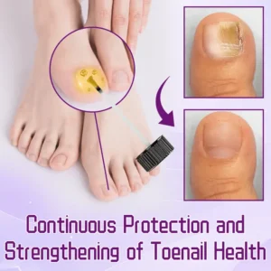 FLYCARE™ FungiGuard Bee Venom Toenail Serum