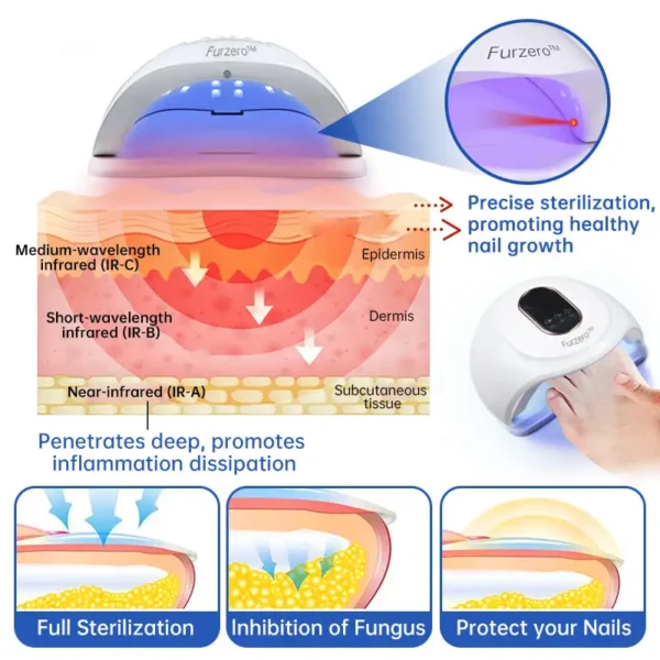 Furzero™ Advanced PureNail Fungus Laser Device