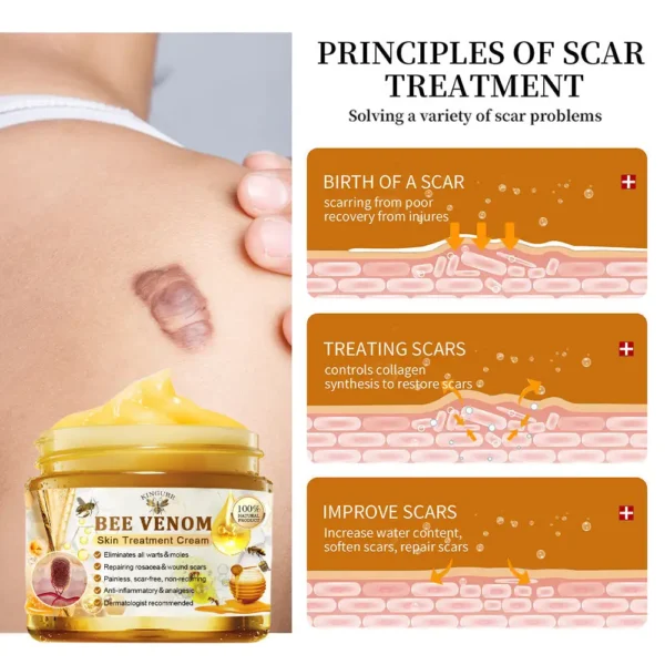 KINGURR™ Bee Venom Skin Treatment Cream