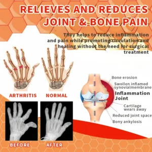 LOVILDS™ Bee Venom Advanced Joint And Bone Therapy Gel