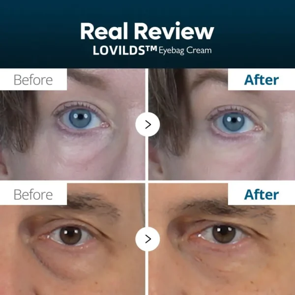 LOVILDS™ Eyebag Cream