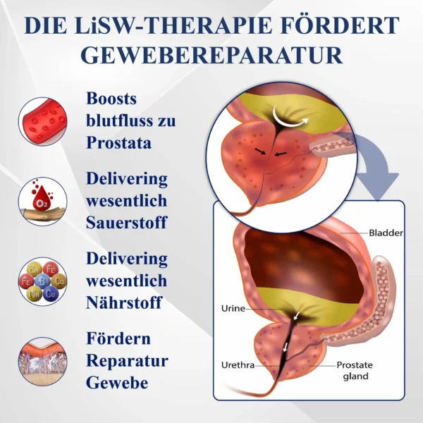 RICPIND™ LiSWT Handgelenkband zur Verbesserung der männlichen Gesundheit