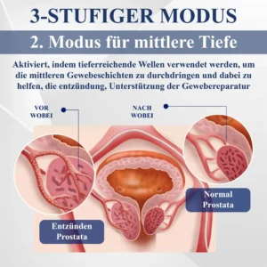 RICPIND™ LiSWT Handgelenkband zur Verbesserung der männlichen Gesundheit