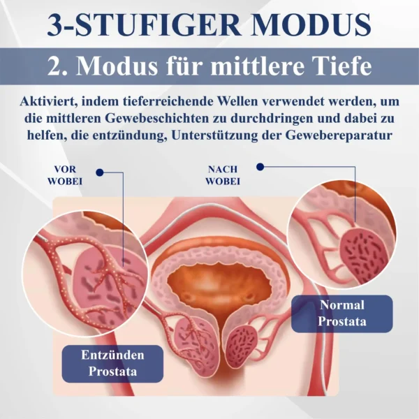 RICPIND™ LiSWT Handgelenkband zur Verbesserung der männlichen Gesundheit