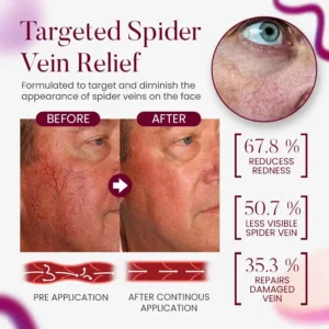 Seurico™Facial Vein Soothing Repair Cream