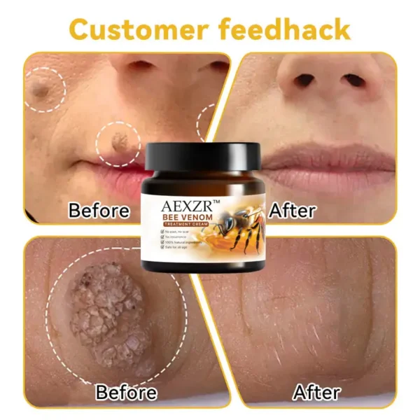 AEXZR™ Bee Venom Skin Treatment Cream