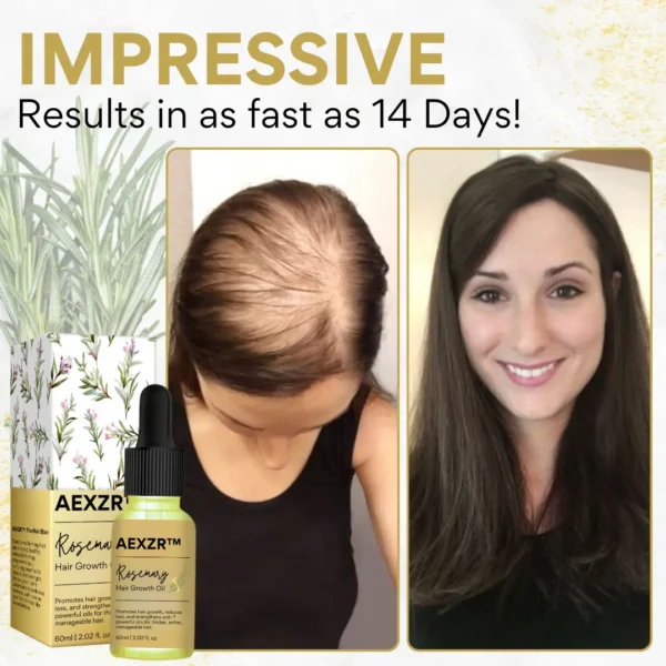 AEXZR™ Rosemary Hair Growth Oil