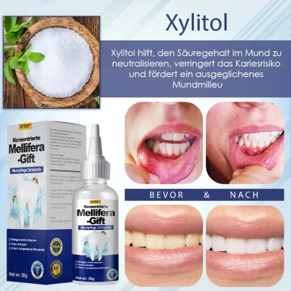 ATTDX™ Konzentrierte Mellifera-Gift Mundpflege Zahnpasta