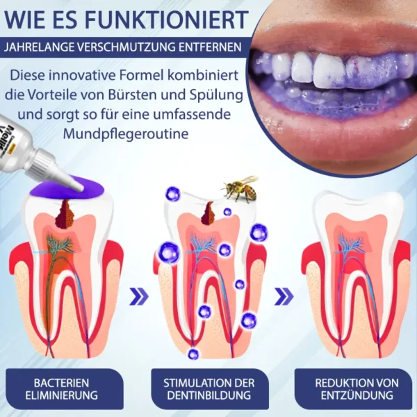 ATTDX™ Konzentrierte Mellifera-Gift Mundpflege Zahnpasta