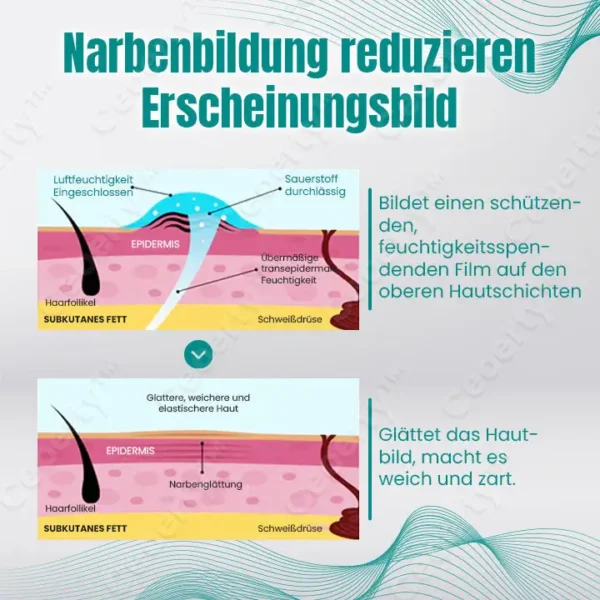 Ceoerty™ RegeniSkin Narbenentfernungsspray