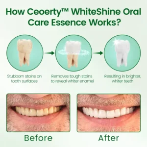 Ceoerty™ WhiteShine Oral Care Essence