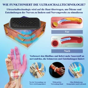 CircuWave™ Venenunterstützungs UltrasonicBand