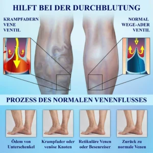 CircuWave™ Venenunterstützungs UltrasonicBand