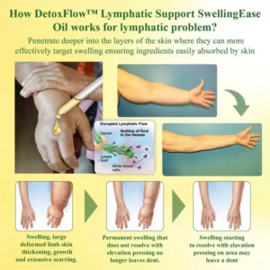 DetoxFlow™ Lymphatic Support SwellingEase Oil