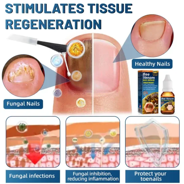 FLYCARE™ BeeVenom Nail Repair Treatment