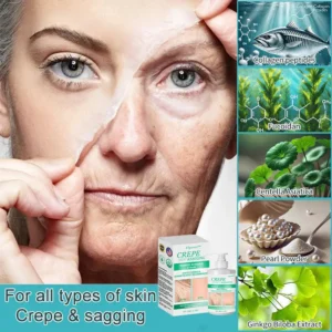 Flysmus™ Wrinkle Removel Cream