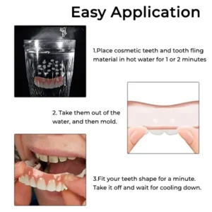 Oveallgo™ Comfort Soft Denture Reline Kit