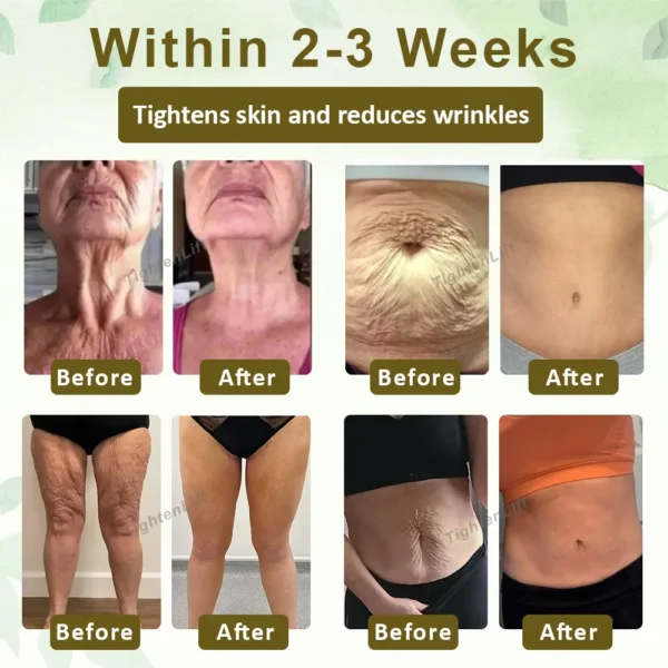 TightenLift™ SkinRenewal FirmingOil