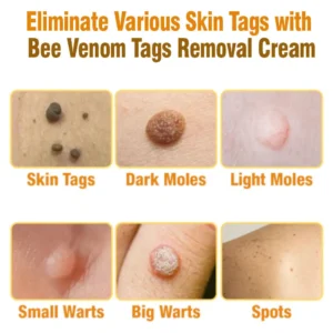 flysmus™ Bee Venom Tags Removal Cream