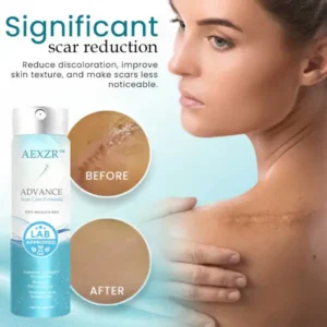 AEXZR™ Advance Scar Care Formulah