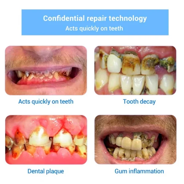 Doctia™ Teeth Restoration Mineral Powder