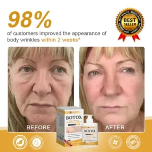 Furzero™ Botox Bee Venom Wrinkle