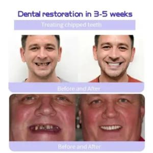 GarageLine™ Teeth Restoration Mineral Powder