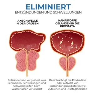 Oveallgo™ BeeBoom Profi Naseninhalator für die Prostatagesundheit