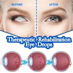 THONESR™ Vision recovery eye drops