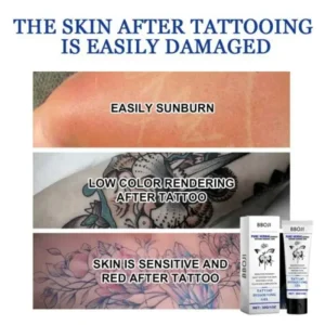 Tattoo Removal Cream: Fast, Painless & Scar-Free Tattoo Erasure