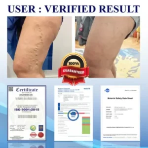 UL certified certified | DIYSTAR™ Ultrasonic Circulation Band