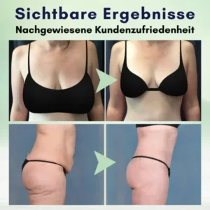 AEXZR™ Erweiterte Straffende Körpercreme