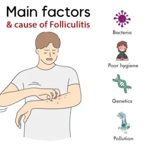 AEXZR™ Folliculitis Clearing Spray