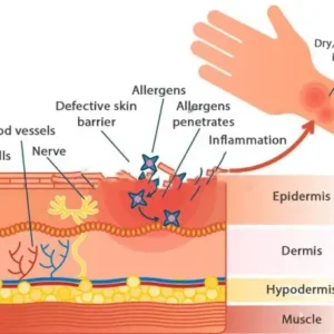 AEXZR™ Folliculitis Clearing Spray