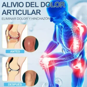 Aeehfeng™ Creman Reparadora Articulacions congs Hialurnico