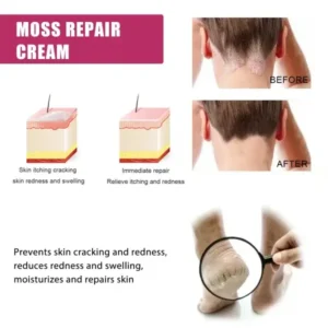 BBOJI™ Multi- Symptom Psoriasis Treatment Cream