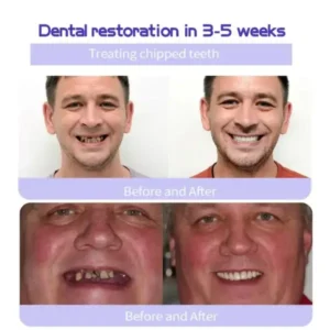 Cvreoz™ Teeth Restoration Mineral Powder