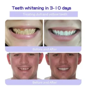 Cvreoz™ Teeth Restoration Mineral Powder