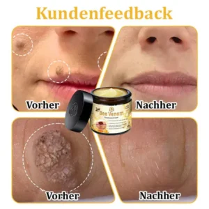 Dermatest-Zertifizierung | Turonu™ Bienengift-Hautcreme