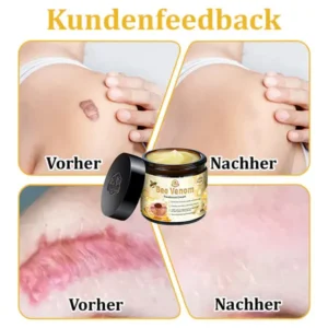 Dermatest-Zertifizierung | Turonu™ Bienengift-Hautcreme